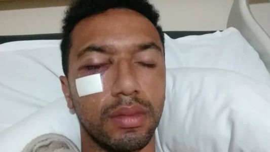 Zagueiro Gualberto precisará passar por cirurgia no olho