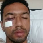 Ex-zagueiro de América e Palmeiras faz 'vaquinha' para pagar cirurgia 