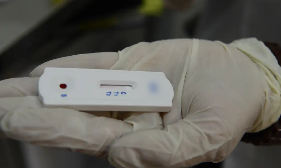 Teste rápido para diagnóstico de infecções sexualmente transmissíveis já está disponível nos postos de BH
