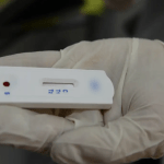 Teste rápido para diagnóstico de infecções sexualmente transmissíveis já está disponível nos postos de BH
