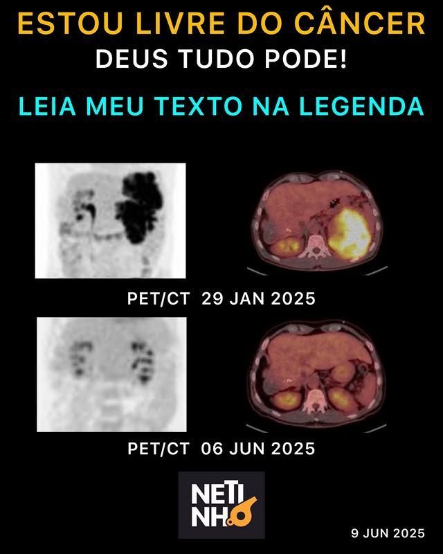 Netinho anuncia remissão do câncer