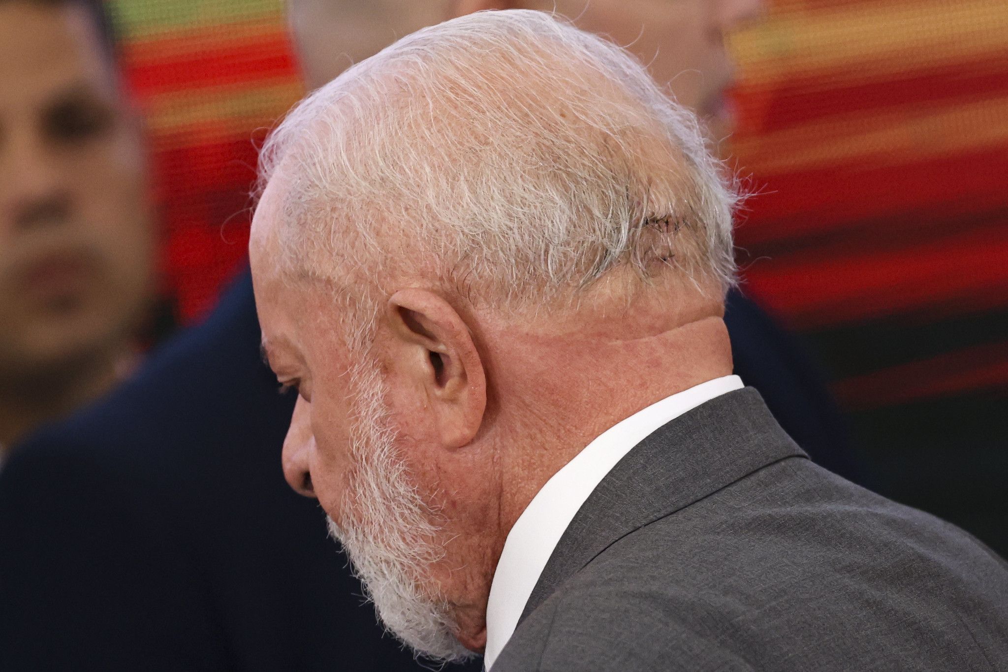 Lula passa por novo exame cerebral após queda