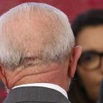 Lula: neurocirurgião detalha sangramento intracraniano do presidente