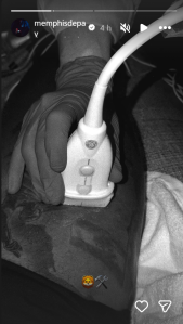 Memphis Depay se recupera de um estiramento na coxa direita