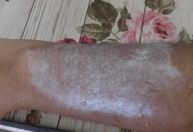 Fãs relatam queimaduras com pulseiras em show de Luan Santana em BH