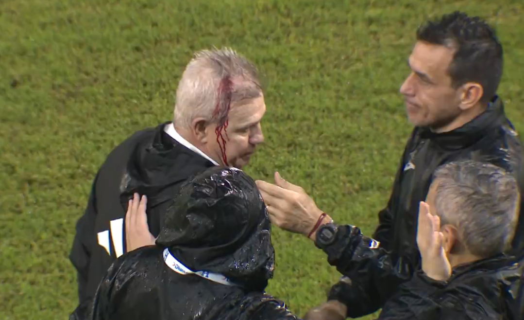 Técnico de seleção deixa campo coberto de sangue ao ser acertado por objeto; assista
