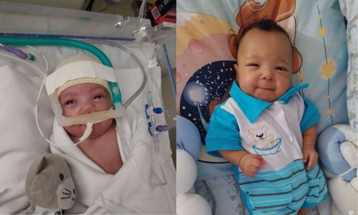 Felipe nasceu com apenas 28 semanas, 867 gramas e 34 centímetros e foi considerado prematuro extremo