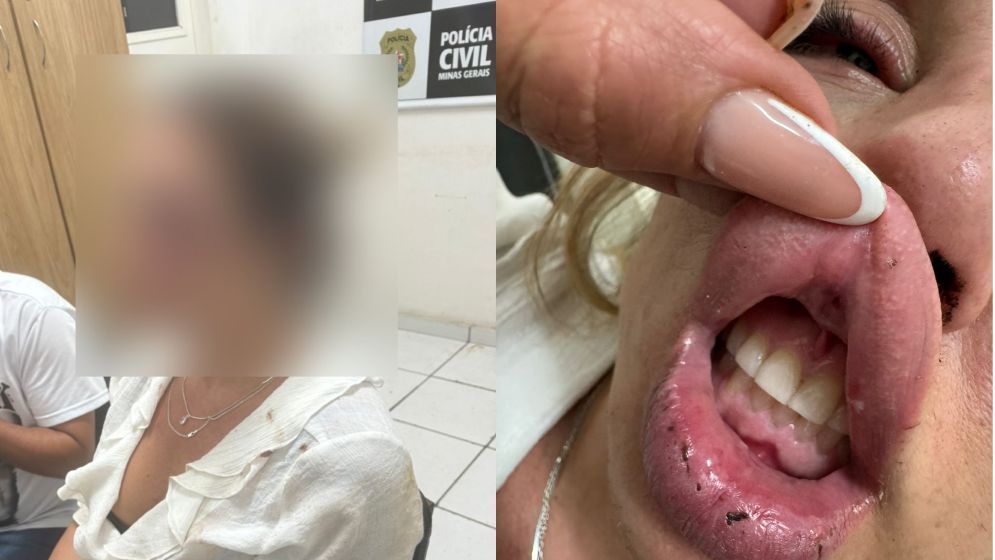 Homem é preso suspeito de agredir noiva e jogá-la do carro na BR-040 na Grande BH