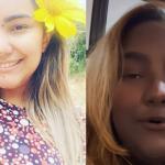 Jovem abandonou os estudos devido a tumor raro que causou mudança na cor da pele
