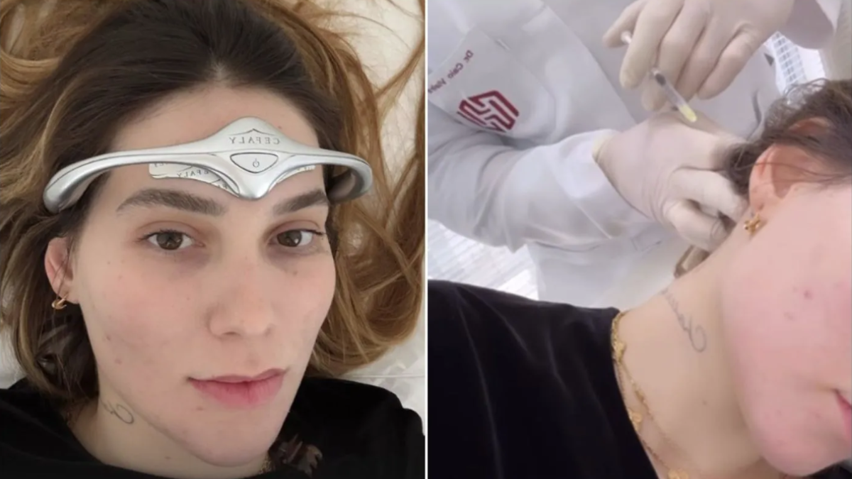 Botox: saiba como funciona tratamento para enxaqueca feito por Virgínia Fonseca