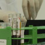 Órgãos infectados com HIV: Saúde do RJ faz testes da doença em pacientes transplantados