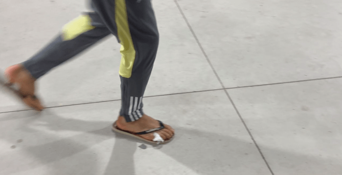 Scarpa foi visto com um curativo no pé direito Scarpa foi visto com um curativo no pé direito