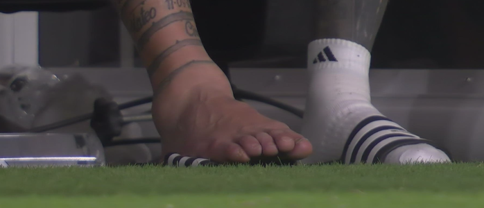 Lionel Messi machucou o tornozelo direito na decisão da Copa América