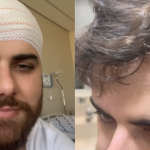 Zé Neto impressiona ao mostrar cicatriz gigante na cabeça após acidente; veja