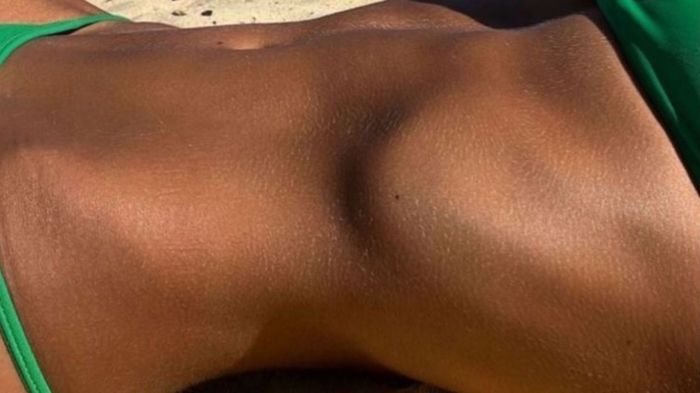 Como conquistar o bronze perfeito sem agredir a pele no verão
