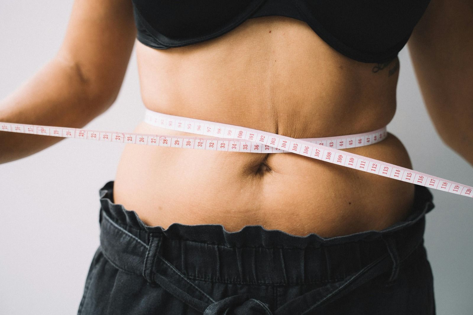 Mito ou verdade: é preciso emagrecer antes de uma cirurgia plástica abdominal?