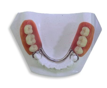 Casal vai a motel para fazer as pazes e reencontro termina em briga com prótese dentária em Betim