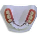 Casal vai a motel para fazer as pazes e reencontro termina em briga com prótese dentária em Betim