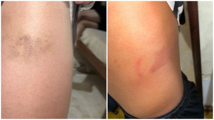 Pais de atletas da base do Athletic denunciaram ameaças e agressões de outros jogadores da base da equipe Pais de atletas da base do Athletic denunciaram ameaças e agressões de outros jogadores da base da equipe