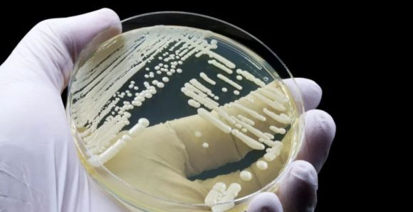 Superfungo Candida auris