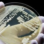 BH tem três casos confirmados de infecção por superfungo Candida auris