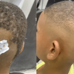 'Dia do Cabelo Maluco': barbeiro viraliza ao mostrar cabeça de criança com machucados causados por cola