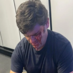 Após levar soco em debate, marqueteiro de Nunes toma medida drástica contra assessor de Marçal