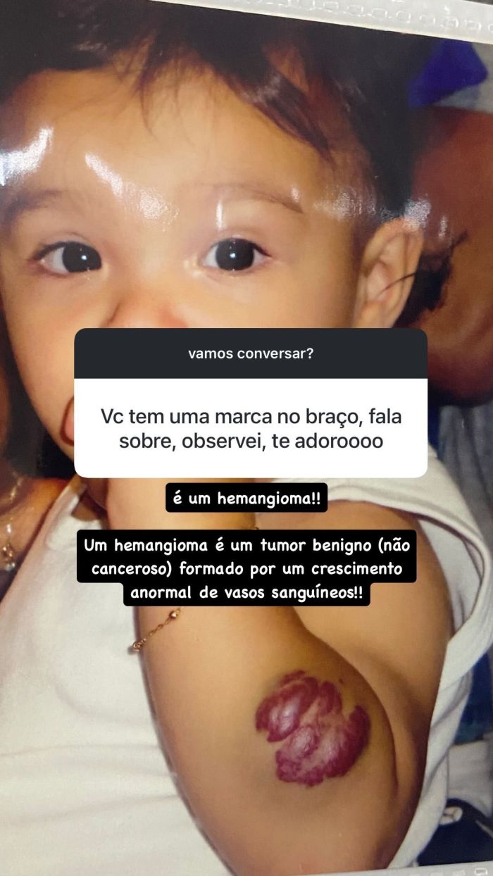 Duda Guerra mostra tumor no braço