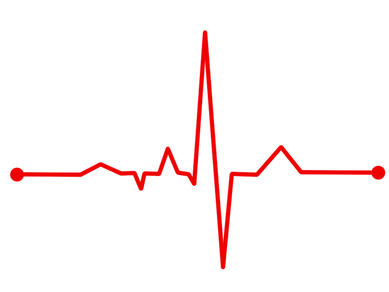 Como funciona eletrocardiograma feito em casa?