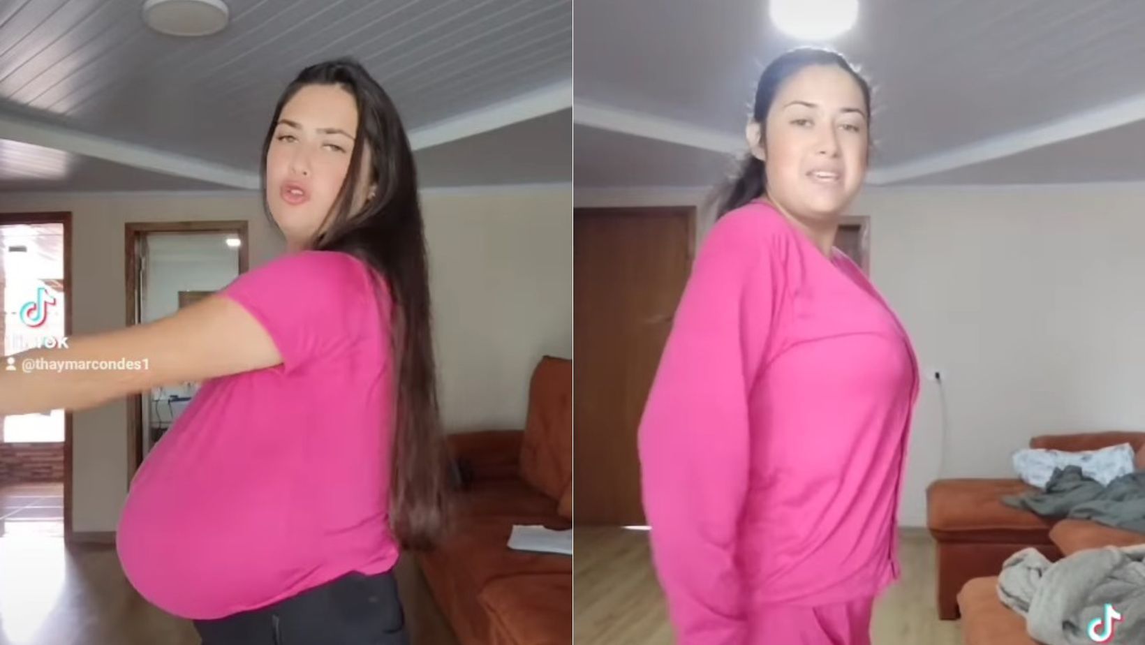 Estudante com doença rara faz cirurgia e retira 10 kg de mama no Paraná; veja fotos