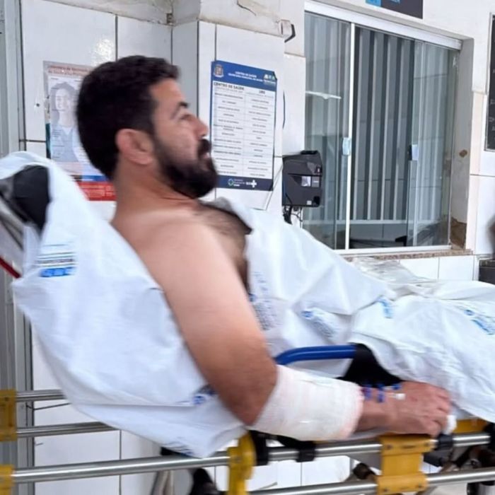 Ex-prefeito de Martins Soares após ser atingido por dois tiros, no sábado (8).