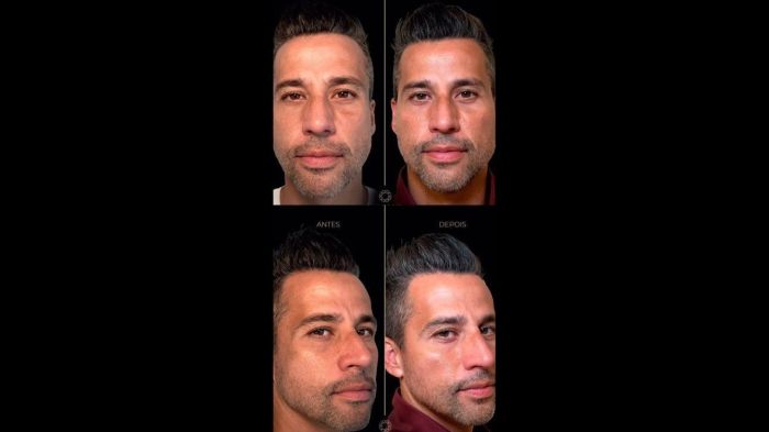 Fábio, do Fluminense, fez procedimento facial com cirurgiã do Paraná