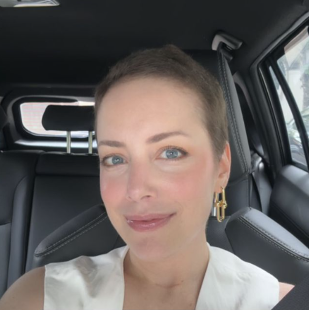 Fabiana Justus reflete sobre convívio com o câncer: 'longe da vida normal'