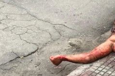 Cansada de apanhar, mulher acerta facada no pescoço de companheiro em Betim