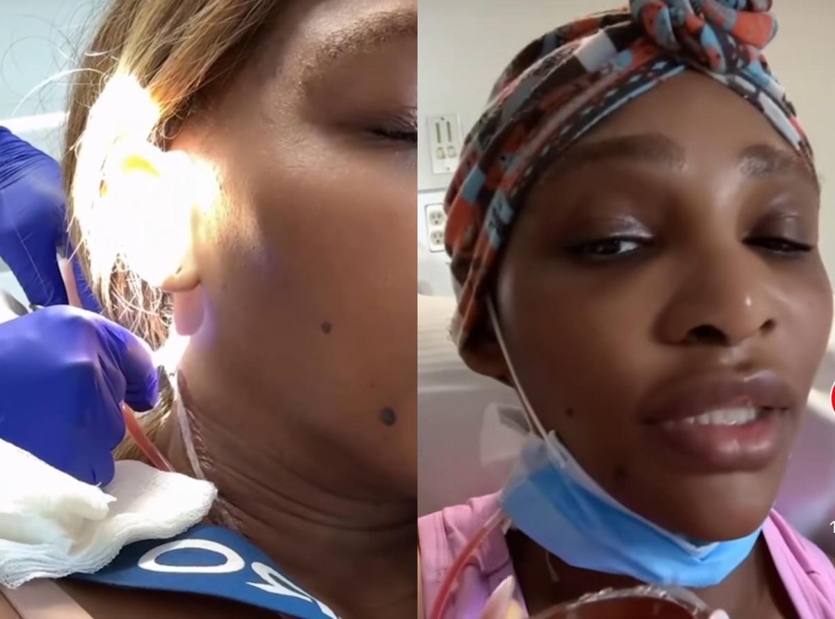 Lenda do tênis, Serena Williams passa por cirurgia para retirar tumor