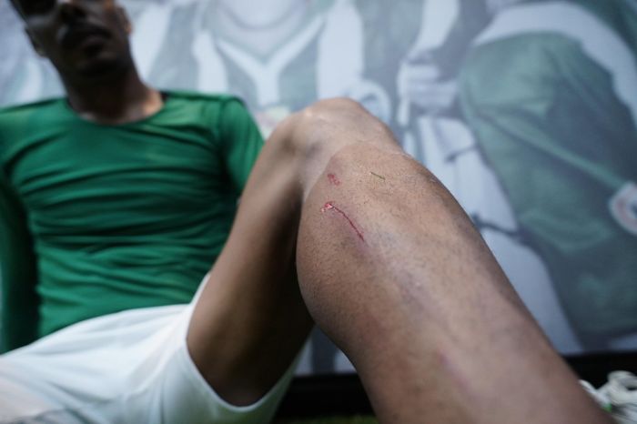 Juventude postou foto da perna de Caíque após entrada de Victor Gabriel, do Inter