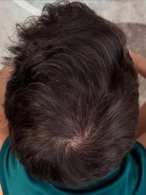 Gustavo Marsengo exibe mudanças