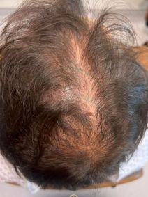 Gustavo Marsengo exibe mudanças