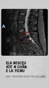Exame publicado por Ana Paula na época da cirurgia • Reprodução/Redes Sociais