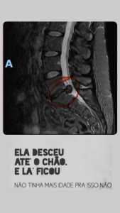 Exame publicado por Ana Paula na época da cirurgia • Reprodução/Redes Sociais