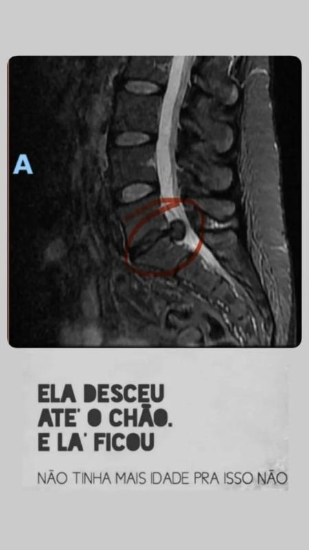 Exame publicado por Ana Paula na época da cirurgia • Reprodução/Redes Sociais