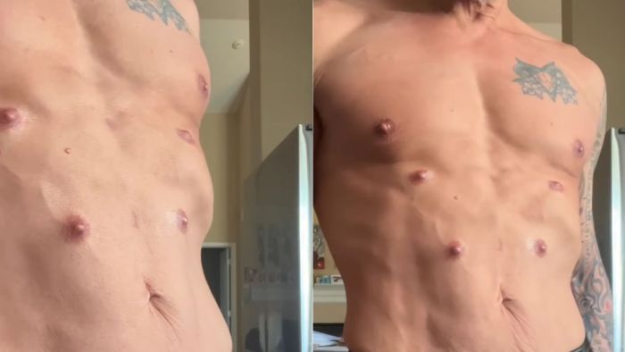 Implantes de silicone tiveram que esperar quatro meses para ser cobertos de tinta em estúdio de tatuagem. Implantes de silicone tiveram que esperar quatro meses para ser cobertos de tinta em estúdio de tatuagem.