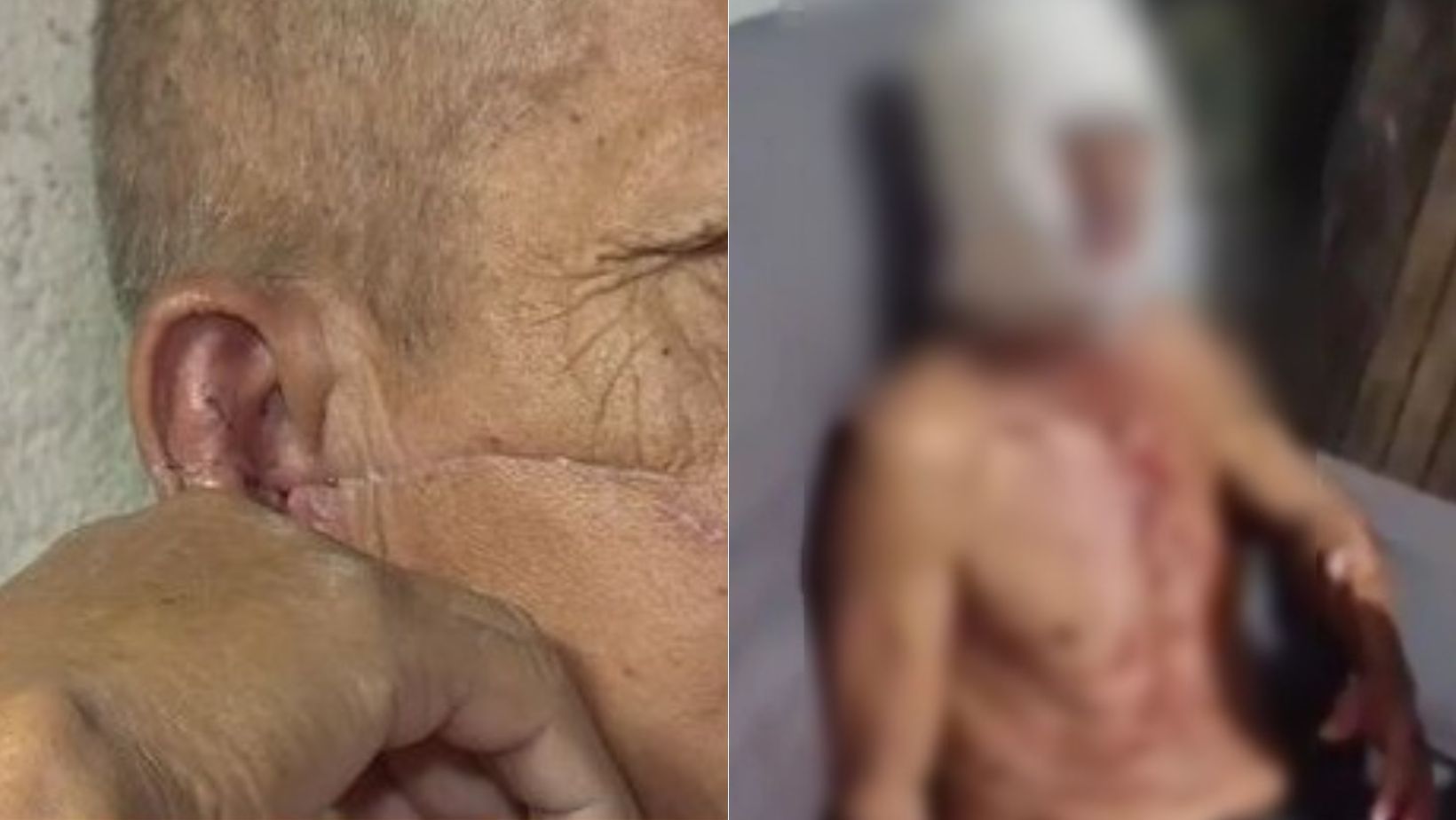 Homem é preso suspeito de golpear seis vezes o sogro com uma foice; idoso levou 200 pontos