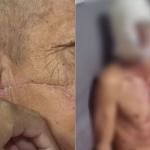 Homem é preso suspeito de golpear seis vezes o sogro com uma foice; idoso levou 200 pontos