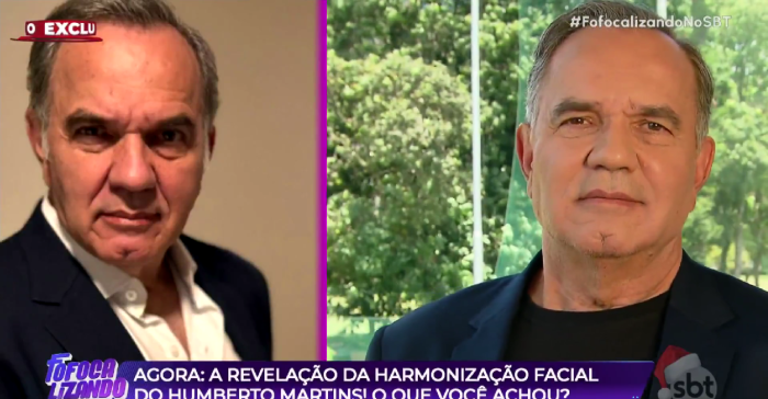Veja antes e depois do ator Humberto Martins