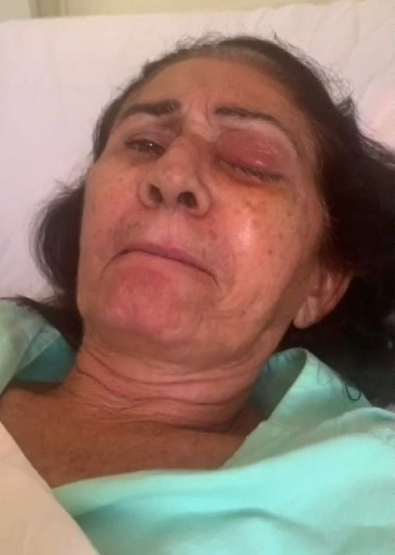 Pacientes perdem a visão depois de mutirão de cirurgias em Parelhas. Pacientes perdem a visão depois de mutirão de cirurgias em Parelhas.
