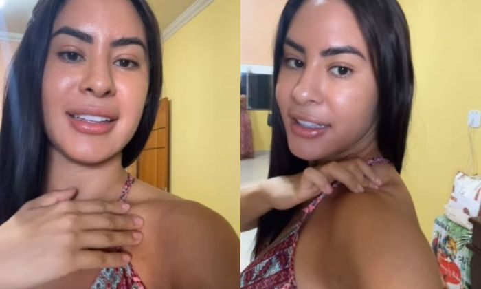 Isabelle Nogueira mostrou machucados no corpo após o festival de Parintins