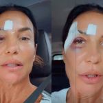 Ivete Sangalo: entenda o que é a síncope vasovagal que levou à internação da cantora