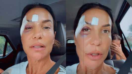 Ivete Sangalo recebe alta após internação