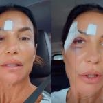 Ivete Sangalo: entenda o que é a síncope vasovagal que levou à internação da cantora